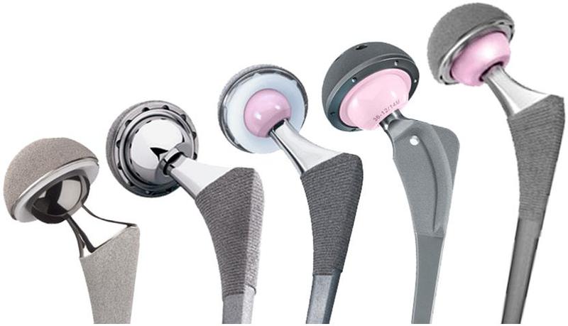 Эндопротезы